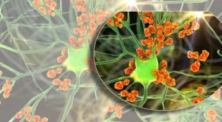 ভারতে ছড়াচ্ছে জিবিএস রোগ, প্রথম মৃত্যু